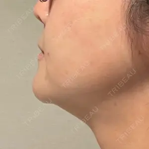 東京美容外科 梅田院口コミ