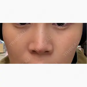 MIO CLINIC 梅田院口コミ