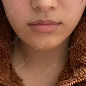 HAAB×DREAM BEAUTY CLINIC 大阪梅田院口コミ