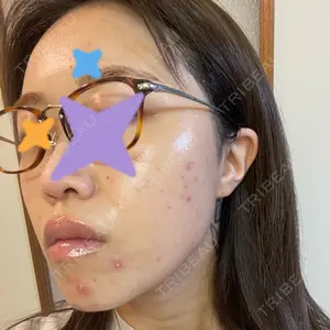 ルラ美容クリニック 新宿院口コミ