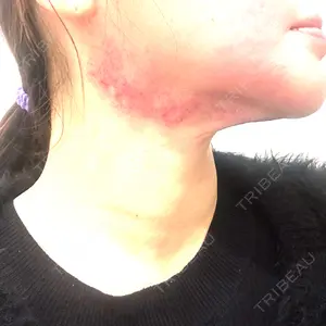 ルラ美容クリニック 横浜院口コミ