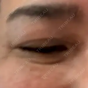 東京ココセランクリニック口コミ