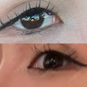 PRO CLINIC プロクリニック 銀座院口コミ