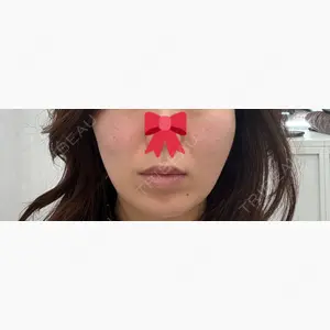 APスキンクリニック銀座口コミ