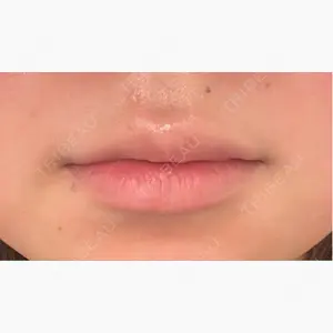 ルラ美容クリニック 岡山院口コミ