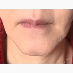 ノリス美容クリニック口コミ