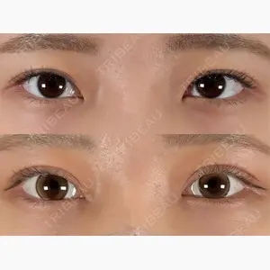 神戸美容外科 ネビュラクリニック口コミ