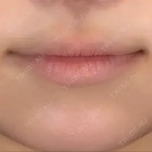 アリエル美容クリニック 横浜院口コミ