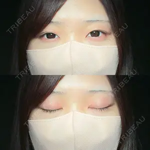 アリエル美容クリニック 大宮院口コミ