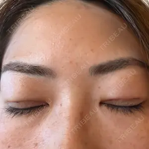 TCB東京中央美容外科 船橋院口コミ