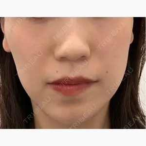 TCB東京中央美容外科 名古屋栄院口コミ