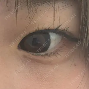 YBC横浜美容外科 立川院口コミ