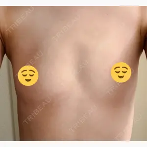 R Beauty CLINIC 銀座院口コミ