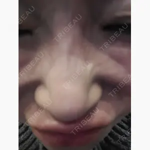 TCB東京中央美容外科 長崎院口コミ