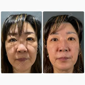 神戸美容外科 ネビュラクリニック口コミ