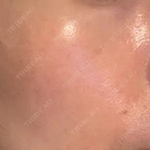 品川スキンクリニック広島院口コミ