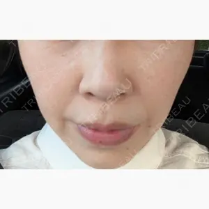 ルラ美容クリニック 岡山院口コミ