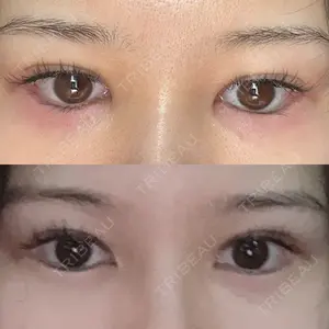 札幌美容外科ネビュラクリニック口コミ