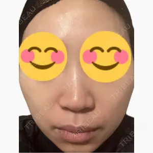 美容皮膚科エルムクリニック 麻布院口コミ