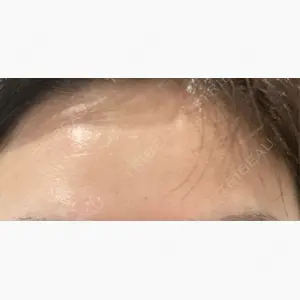 ルラ美容クリニック 札幌本院口コミ