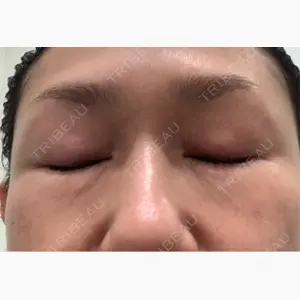 Chloe Cheongdam Clinic （クロエチョンダムクリニック）口コミ