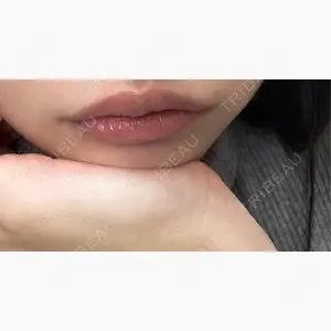 PRISM Beauty Clinic 町田院口コミ