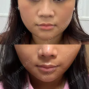 TCB東京中央美容外科 岐阜院口コミ