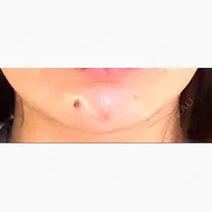 銀座リシェスクリニック口コミ