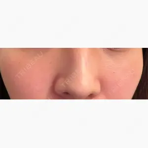 Belle Via Skin Clinic口コミ