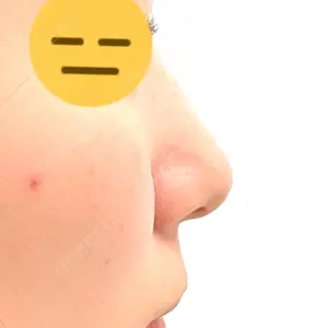 新宿美容外科ネビュラクリニック口コミ