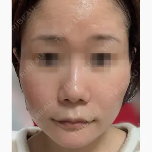 DAILY SKIN CLINIC 心斎橋院口コミ