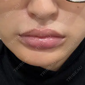 BAO CLINIC 梅田院口コミ