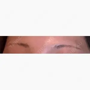 平和台皮フ科口コミ