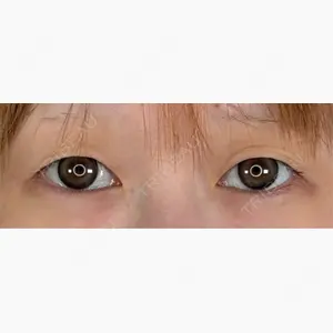 アリエル美容クリニック 郡山院口コミ