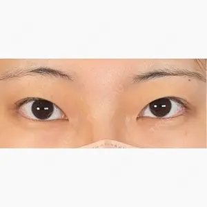 アリエル美容クリニック 大宮院口コミ