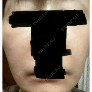 ハナビューティークリニック口コミ