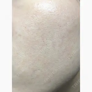 MIO CLINIC 梅田院口コミ