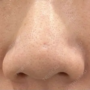 新宿ラクル美容外科クリニック 新宿院口コミ