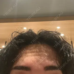 共立美容外科 広島院口コミ