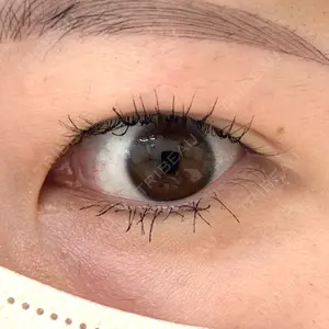 フィラークリニック 新宿院口コミ