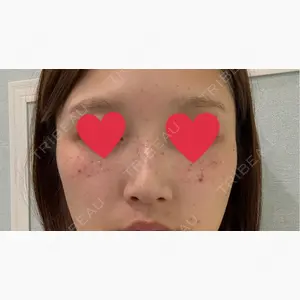 ルラ美容クリニック 仙台院 / ルラスキンクリニック 仙台院口コミ