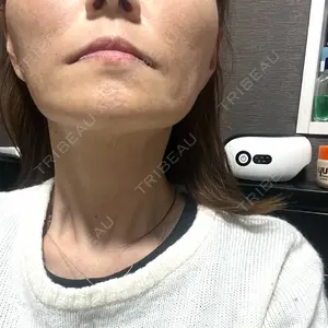 TCB東京中央美容外科 佐賀院口コミ