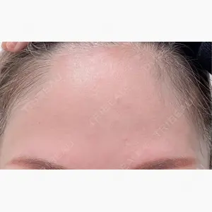 TCB東京中央美容外科 新宿東口院口コミ