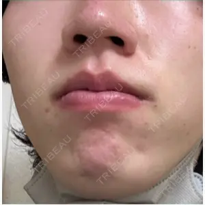 AB美容クリニック 新宿院口コミ