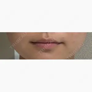 オーキッド美容クリニック東京御徒町口コミ