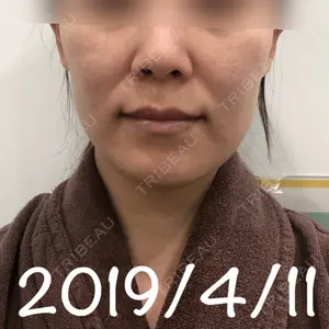 エートップ美容整形外科口コミ