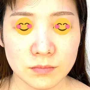 APスキンクリニック銀座口コミ