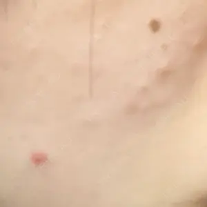 Belle Via Skin Clinic口コミ