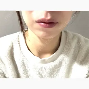 ルラ美容クリニック 札幌本院口コミ