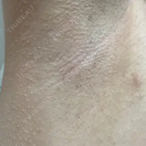 ルラ美容クリニック 神戸院口コミ